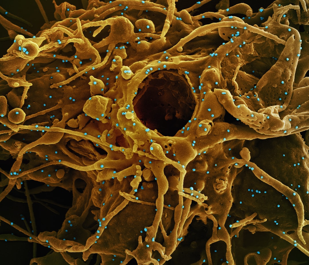 膵臓の神経細胞のイメージ